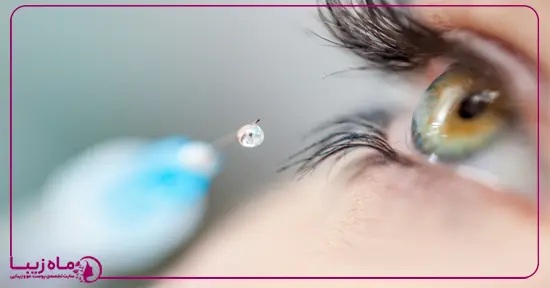 تزریق بوتاکس برای انحراف چشم واقعی است؟