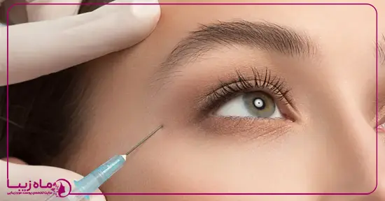 تزریق بوتاکس برای بالا بردن ابرو