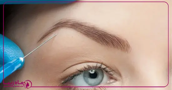 عوارض بوتاکس ابرو