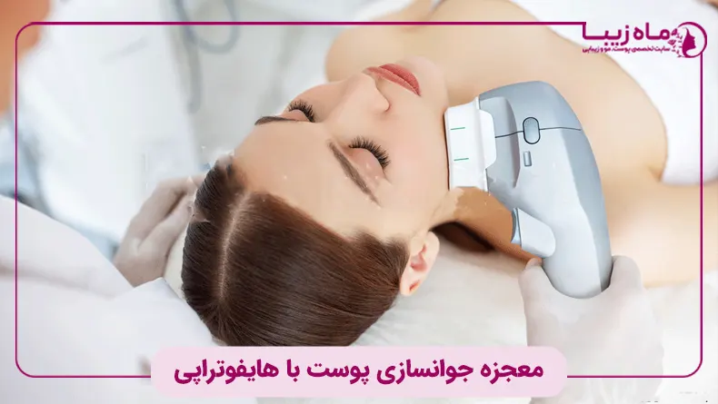 هایفوتراپی چیست؟ معجزه جوانسازی پوست با هایفوتراپی