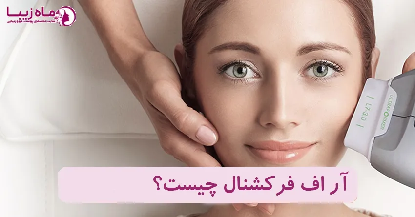 آر اف فرکشنال چیست؟