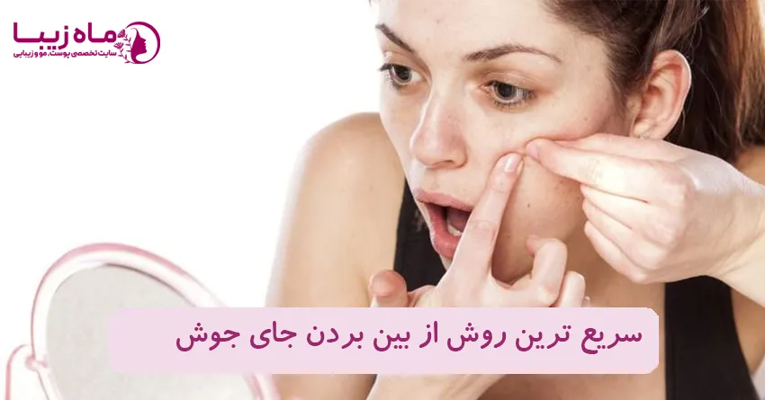 سریع ترین روش از بین بردن جای جوش