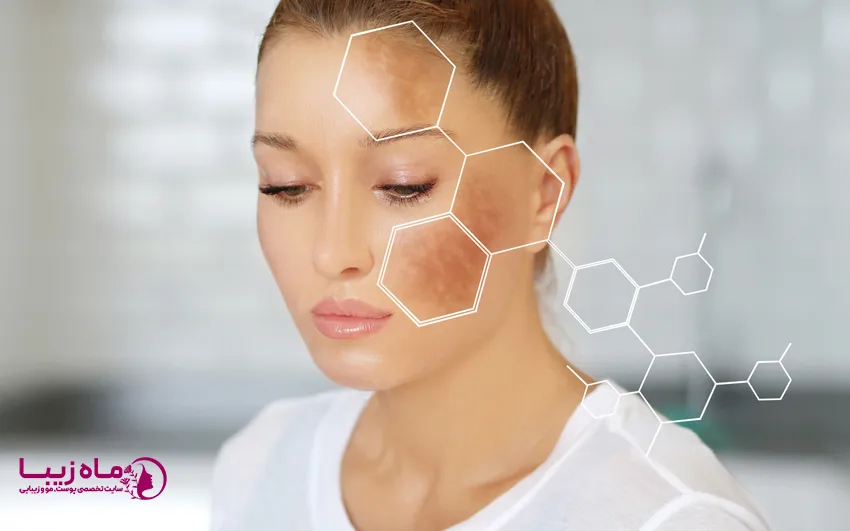 کک و مک چگونه به وجود می آید؟